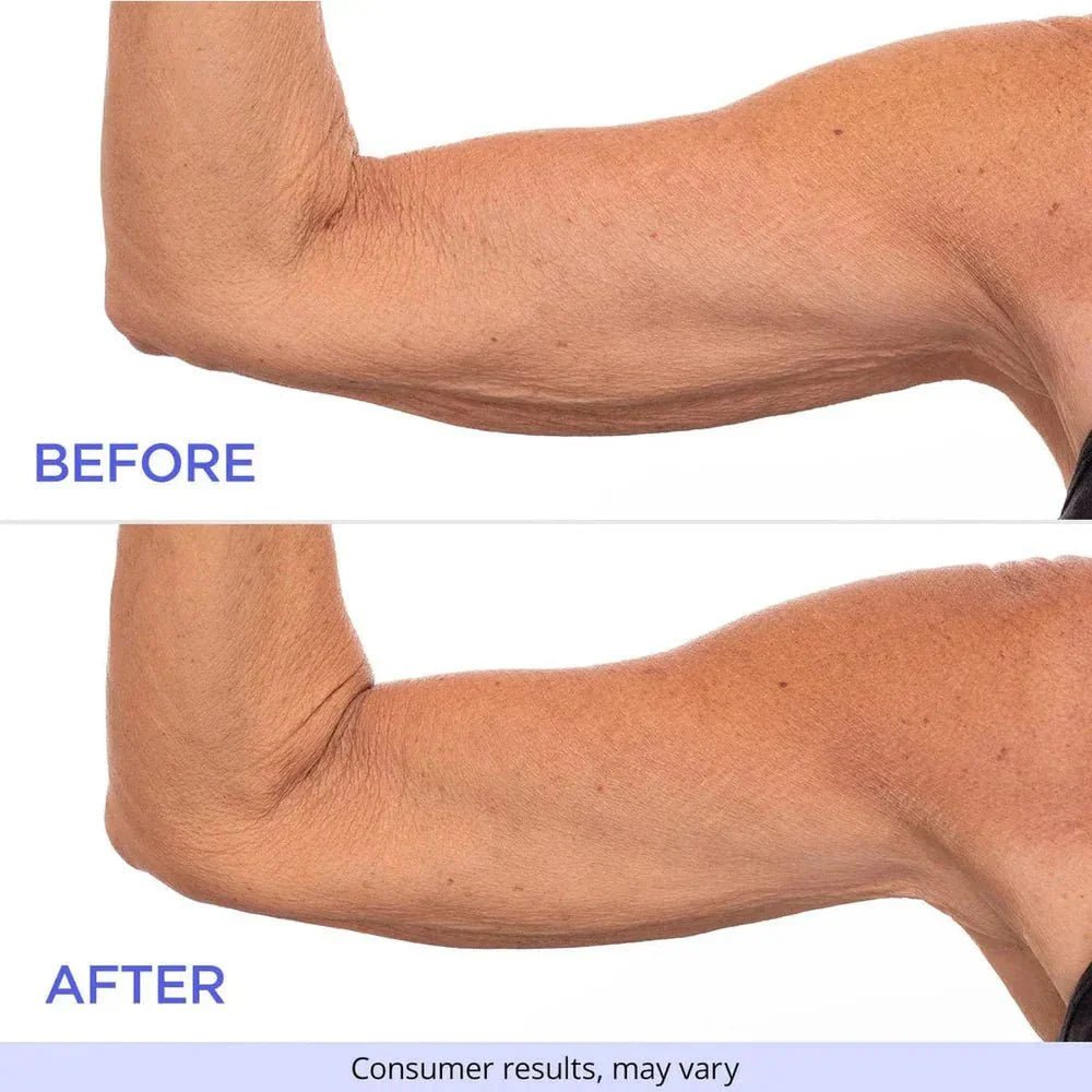 SculptSkin™ - For Firm and Smooth Skin – Effortlessly - Levora