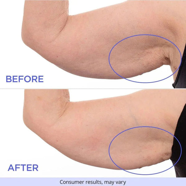SculptSkin™ - For Firm and Smooth Skin – Effortlessly - Levora
