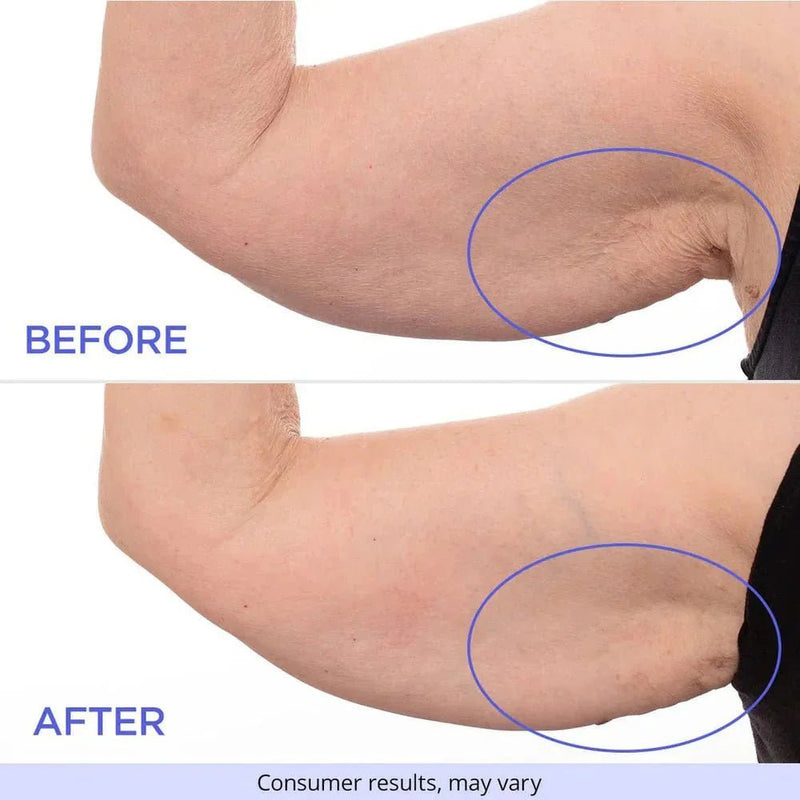 SculptSkin™ - For Firm and Smooth Skin – Effortlessly - Levora