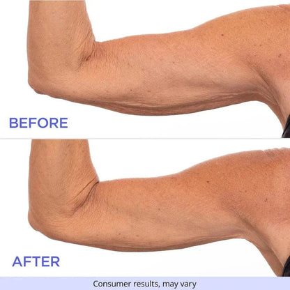 SculptSkin™ - For Firm and Smooth Skin – Effortlessly - Levora