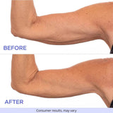 SculptSkin™ - For Firm and Smooth Skin – Effortlessly - Levora