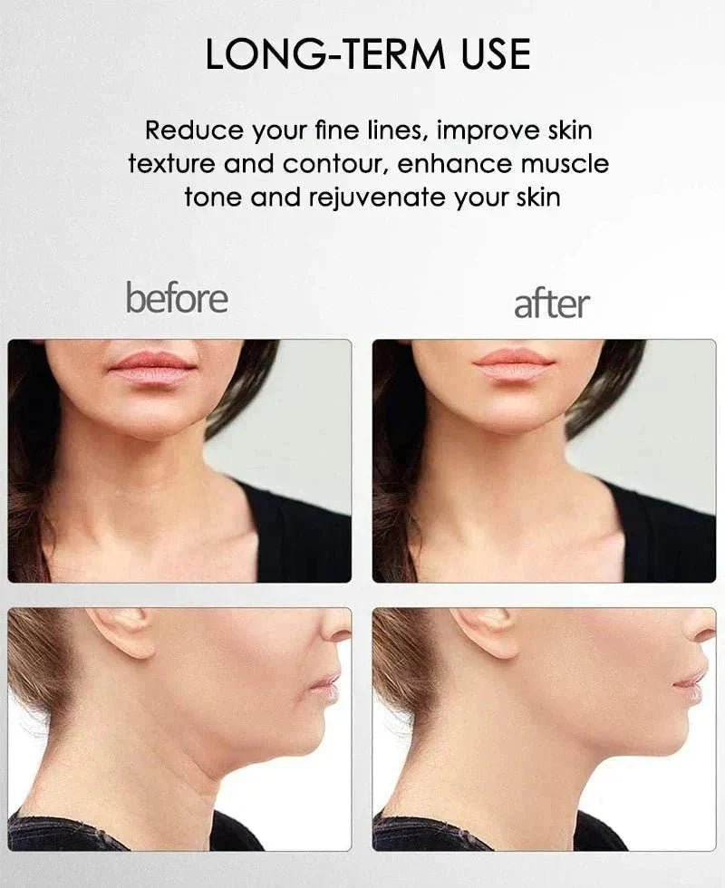 Skinlift™ - The solution for clean and healthy skin! - Levora